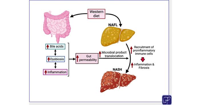 Thieme E-Journals - Seminars in Liver Disease / Abstract